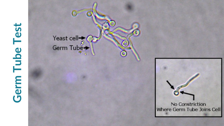 germ tube test for candida albicans